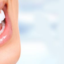 How to Keep Your Teeth White After the Teeth Whitening Treatment