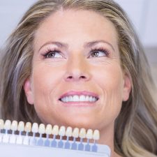 Dental Veneers- Boon To The Dental Industry